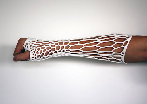 5 Innovative and Cutting-Edge 3D-Printed Medical Devices