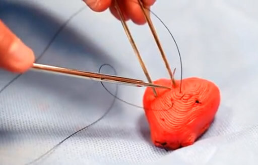 5 Innovative and Cutting-Edge 3D-Printed Medical Devices